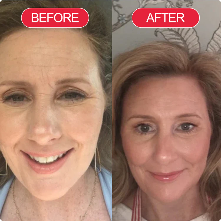 Korean Centella Premium Skincare Set (5 Pcs™)