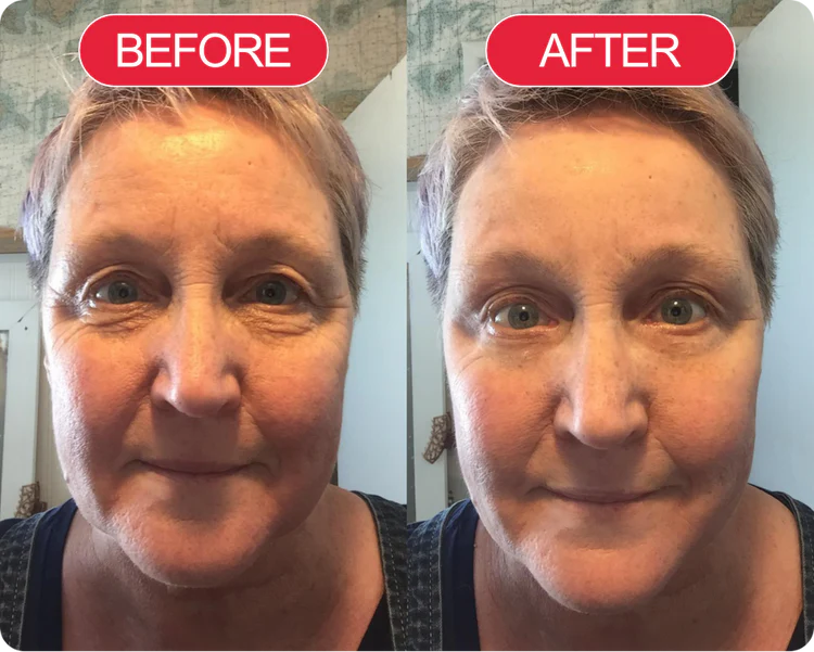 Korean Centella Premium Skincare Set (5 Pcs™)