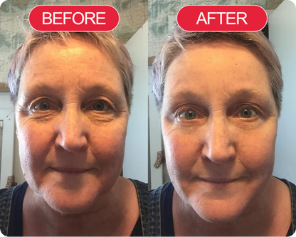 Korean Centella Premium Skincare Set (5 Pcs™)