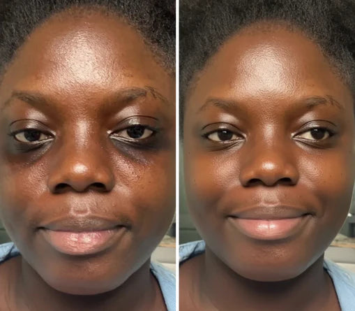 Korean Centella Premium Skincare Set (5 Pcs™)