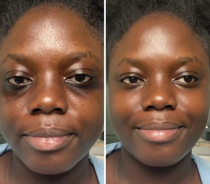 Korean Centella Premium Skincare Set (5 Pcs™)