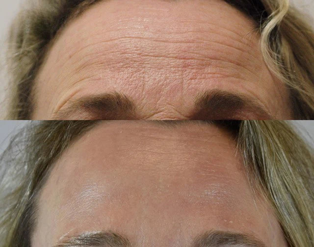 Korean Centella Premium Skincare Set (5 Pcs™)